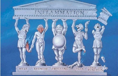 Gyulladásos folyamatok